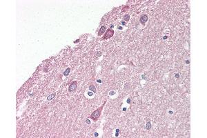 Anti-LIS1 antibody IHC of human brain, cortex.