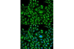Immunofluorescence analysis of U2OS cell using HSPA1L antibody.