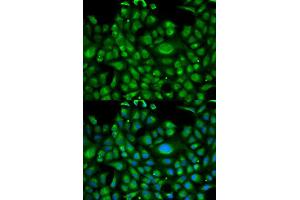 Immunofluorescence analysis of U2OS cell using HSPA1L antibody. (HSPA1L anticorps  (AA 342-641))