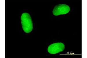 Immunofluorescence of purified MaxPab antibody to MAGEB1 on Hs 181.