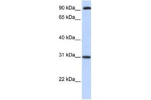 ANKRA2 antibody used at 0. (ANKRA2 anticorps  (C-Term))