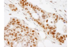 Immunohistochemistry (IHC) image for anti-Chromosome 7 Open Reading Frame 27 (C7orf27) (C-Term) antibody (ABIN7453660)