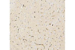 IHC analysis of SLC2A1 using anti-SLC2A1 antibody (ABIN3043927).