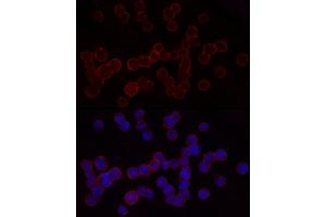 Immunofluorescence analysis of U-937 cells using CD18 Rabbit pAb (ABIN3023117, ABIN3023118, ABIN3023119 and ABIN6219398) at dilution of 1:50 (40x lens).