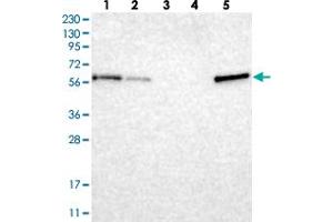 Western blot analysis of Lane 1: RT-4, Lane 2: U-251 MG, Lane 3: Human Plasma, Lane 4: Liver, Lane 5: Tonsil with TXNDC10 polyclonal antibody . (TMX3 anticorps)