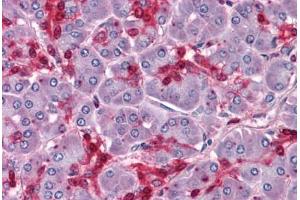 Human Pancreas: Formalin-Fixed, Paraffin-Embedded (FFPE)