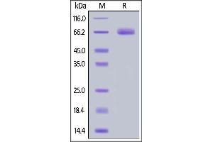 Cynomolgus B7-H3, His Tag on  under reducing (R) condition.