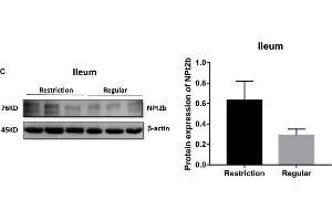 Effects of dietary non-phytate phosphorus levels (restriction, 0.