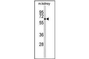 Western blot analysis of CYP27B1 Antibody (C-term)  in mouse kidney tissue lysates (35ug/lane). (CYP27B1 anticorps  (C-Term))