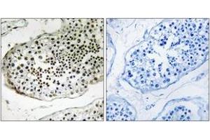 Immunohistochemistry analysis of paraffin-embedded human testis tissue, using UBQLN3 Antibody. (Ubiquilin 3 anticorps  (AA 271-320))