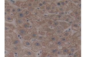 DAB staining on IHC-P; Samples: Human Liver Tissue (CYP26B1 anticorps  (AA 1-512))