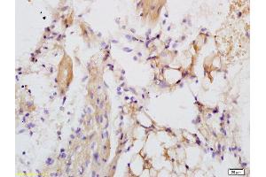 Formalin-fixed and paraffin embedded rat heart labeled with Anti-LRIG1 Polyclonal Antibody, Unconjugated (ABIN735263) at 1:200 followed by conjugation to the secondary antibody and DAB staining.