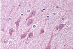 Human Brain, Cortex (formalin-fixed, paraffin-embedded) stained with TICAM1 antibody ABIN213993 at 5 ug/ml followed by biotinylated goat anti-rabbit IgG secondary antibody ABIN481713, alkaline phosphatase-streptavidin and chromogen. (TICAM1 anticorps  (C-Term))