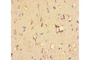 Immunohistochemistry of paraffin-embedded human brain tissue using ABIN7169664 at dilution of 1:100