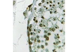 Immunohistochemical analysis of Ubiquilin 3 staining in human testis formalin fixed paraffin embedded tissue section.