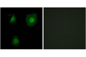 Immunofluorescence analysis of A549 cells, using EID1 Antibody.