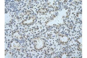 Rabbit Anti-HNRNPF Antibody       Paraffin Embedded Tissue:  Human alveolar cell   Cellular Data:  Epithelial cells of renal tubule  Antibody Concentration:   4. (HNRNPF anticorps  (C-Term))
