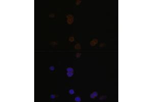 Immunofluorescence analysis of Y79 cells using RCVRN antibody (ABIN6128676, ABIN6146832, ABIN6146833 and ABIN6222036) at dilution of 1:100.