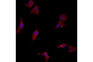 ABIN6262952 and ABIN6277129 staining HepG2 by IF/ICC.