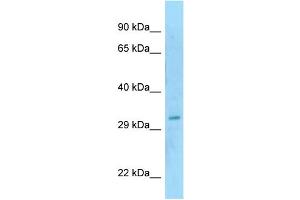 WB Suggested Anti-SAP30BP Antibody Titration: 1. (SAP30BP anticorps  (N-Term))