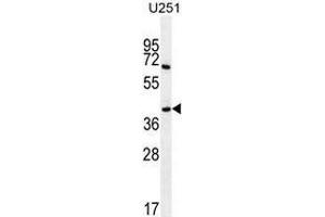 Western blot analysis in U251 cell line lysates (35ug/lane) using Proline-rich protein 16 / PRR16 Antibody (C-term). (PRR16 anticorps  (C-Term))