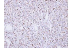 IHC-P Image Immunohistochemical analysis of paraffin-embedded U87 xenograft, using RGMB, antibody at 1:100 dilution. (RGMB anticorps  (Center))