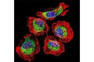 Confocal immunofluorescent analysis of Vimentin antibody with HeLa cells followed by Alexa Fluor 488-conjugated goat anti-rabbit lgG (green).