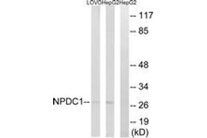 Western blot analysis of extracts from HepG2/LOVO cells, using NPDC1 Antibody. (NPDC1 anticorps  (AA 189-238))