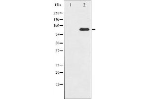 Western blot analysis of PKC theta expression in PMA treated Jurkat whole cell lysates,The lane on the left is treated with the antigen-specific peptide.