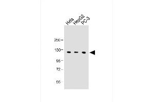 All lanes : Anti-C15orf2 Antibody (Center) at 1:1000 dilution Lane 1: Hela whole cell lysate Lane 2: HepG2 whole cell lysate Lane 3: PC-3 whole cell lysate Lysates/proteins at 20 μg per lane. (NPAP1 anticorps  (AA 348-377))