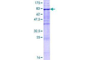 Image no. 1 for UDP Glucuronosyltransferase 1 Family, Polypeptide A9 (UGT1A9) (AA 1-530) protein (GST tag) (ABIN1324582)