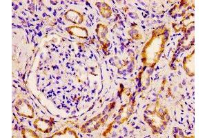 IHC image of ABIN7161406 diluted at 1:500 and staining in paraffin-embedded human kidney tissue performed on a Leica BondTM system. (PNPLA6 anticorps  (AA 345-493))