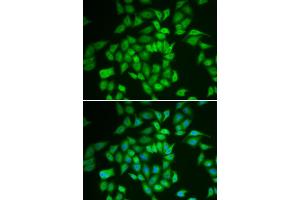 Immunofluorescence analysis of HeLa cells using CSNK1E antibody. (CK1 epsilon anticorps)