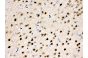 Anti- HDAC11 Picoband antibody,IHC(P) IHC(P): Rat Brain Tissue