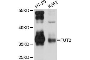Western blot analysis of extracts of various cell lines, using FUT2 antibody (ABIN2562702) at 1:1000 dilution. (FUT2 anticorps)