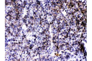 CXCL13/BLC was detected in paraffin-embedded sections of mouse lymphaden tissues using rabbit anti- CXCL13/BLC Antigen Affinity purified polyclonal antibody (Catalog # ) at 1 ?