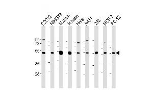 All lanes : Anti-beta II Tubulin Antibody at 1:2000 dilution Lane 1: C2C12 whole cell lysate Lane 2: NIH/3T3 whole cell lysate Lane 3: Mouse brain lysate Lane 4: Human brain lysate Lane 5: Hela whole cell lysate Lane 6: A431 whole cell lysate Lane 7: 293 whole cell lysate Lane 8: MCF-7 whole cell lysate Lane 9: PC-12 whole cell lysate Lysates/proteins at 20 μg per lane. (TUBB2A anticorps  (AA 194-225))