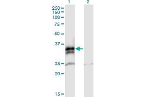 Western Blot analysis of FCN2 expression in transfected 293T cell line by FCN2 MaxPab polyclonal antibody. (Ficolin 2 anticorps  (AA 1-313))
