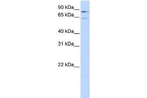 Western Blotting (WB) image for anti-Coagulation Factor 13, B Polypeptide (F13B) antibody (ABIN2458621) (F13B anticorps)