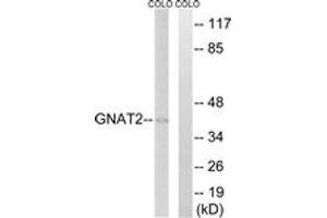 Western blot analysis of extracts from COLO cells, using GNAT2 Antibody. (GNAT2 anticorps  (AA 1-50))