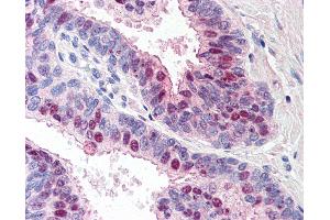 Anti-TARBP1 antibody IHC of human prostate. (TARBP1 anticorps  (Internal Region))