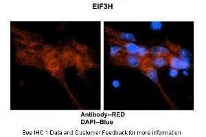 Researcher: Dr. (EIF3H anticorps  (N-Term))