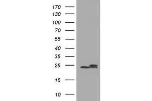 Image no. 9 for anti-NADH Dehydrogenase (Ubiquinone) 1 beta Subcomplex, 10, 22kDa (NDUFB10) antibody (ABIN1499672) (NDUFB10 anticorps)
