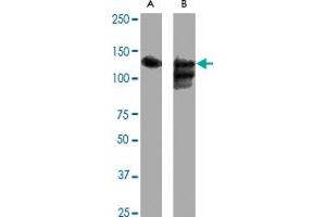 Western blot analysis of SIRT1 polyclonal antibody  expression in Hela (A) and Hela + CoC 12  (B) whole cell lysates. (SIRT1 anticorps  (C-Term))