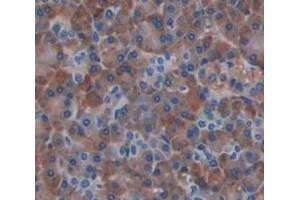IHC-P analysis of Human Tissue, with DAB staining. (CXCL2 anticorps  (AA 34-107))