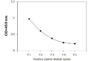 Jurkat cells were treated with Pervanadate. (FYN Kit ELISA)