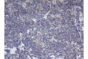 Image no. 1 for anti-B-Cell CLL/lymphoma 10 (BCL10) antibody (ABIN1496847) (BCL10 anticorps)