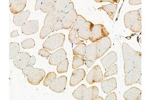 Phospho-PKD1/PKC mu (Ser205) Antibody at 1/100 staining Mouse muscle tissue by IHC-P. (PKC mu anticorps  (pSer205))