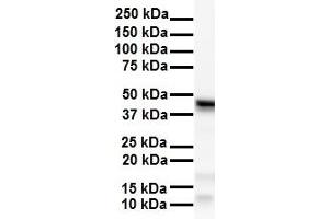 WB Suggested Anti-SMYD5 antibody Titration: 1 ug/mL Sample Type: Human Hela