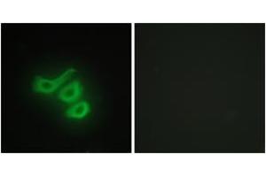 Immunofluorescence analysis of HepG2 cells, using M-CK Antibody. (CKM anticorps  (AA 10-59))